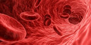 Toxische Metalle erhöhen das Risiko von Arteriosklerose